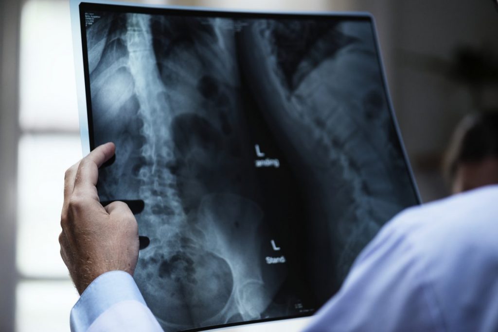 Common Types of Car Accident Chest Injuries